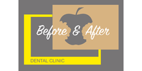 Before & After, стоматологія